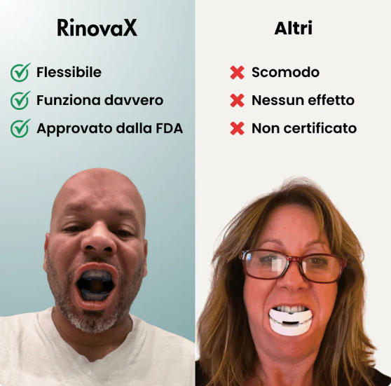 Bite Anti Russamento Silenzioso Universale